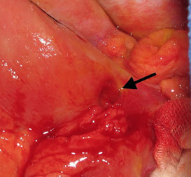 stomach ulcer in dogs gastric ulcer free brochure and treatment tips stomach ulcer in dogs gastric ulcer free brochure and treatment tips
