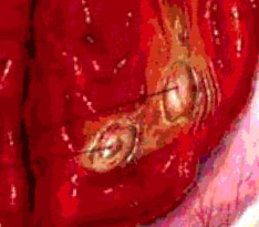 gastritis in dogs gastritis treatment tips and free brochures gastritis in dogs gastritis treatment tips and free brochures