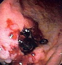stomach ulcer in dogs gastric ulcer free brochure and treatment tips stomach ulcer in dogs gastric ulcer free brochure and treatment tips