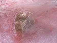 seborrhea dogs cure skin and dandruff in 3 easy steps seborrhea dogs cure skin and dandruff in 3 easy steps