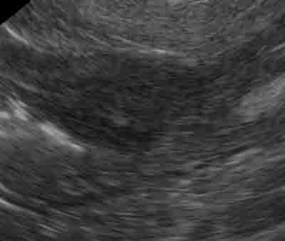 dog gastric tumor - ultrasound - 400px x 339px