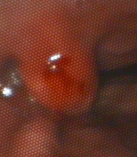 dog benign gastric polyp - example - 282px x 383px