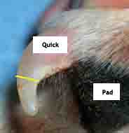 dog nail quick trim line - 184px x 190px - example 8