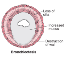 illustration of canine chronic bronchitis symptoms