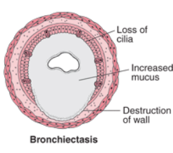 illustration of canine chronic bronchitis symptoms illustration of canine chronic bronchitis symptoms