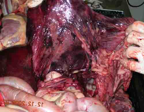 Bloat surgery cost hotsell