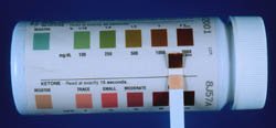 Dog Blood Glucose Test: Positive Dog Blood Glucose Test: Positive