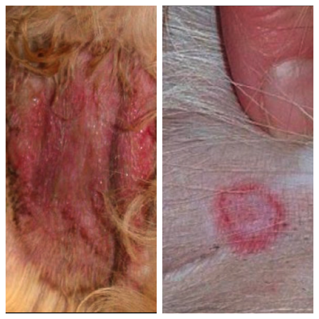 dog hotspot vs ringworm