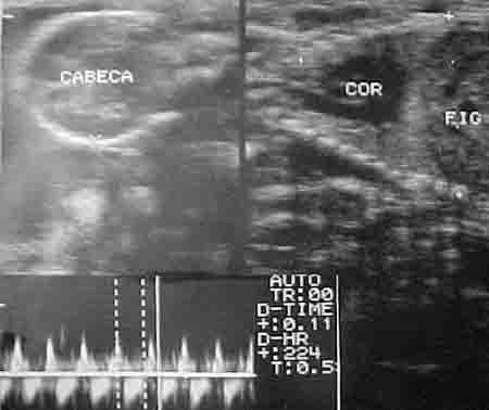 Dog Pregnancy - Ultrasound