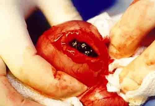 Dog Stomach - Surgery to Remove Foreign Object Dog Stomach - Surgery to Remove Foreign Object
