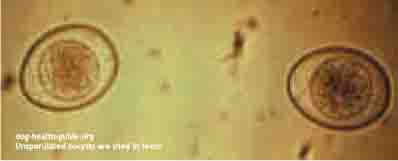Isospora Canine Parasite Isospora Canine Parasite