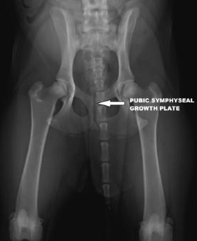 juvenile pubis symphsiodesis x-ray used to correct hip dysplasia