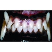 Long Muzzle Greyhound Anterior Canine Teeth Long Muzzle Greyhound Anterior canine teeth