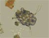Otodectes Cynotis Otodectes Cynotis