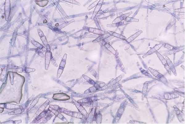 Magnified View of Dog Ringworm Spores