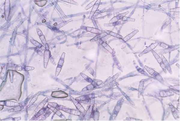 Magnified View of Dog Ringworm Spores Magnified View of Dog Ringworm Spores