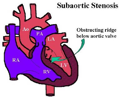dog subaortic stenosis dog subaortic stenosis