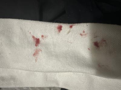 Bleeding 10 Weeks After C Section