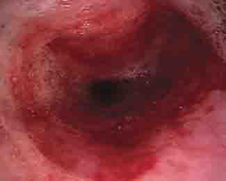 Dog With Esophagitis Dog With Esophagitis