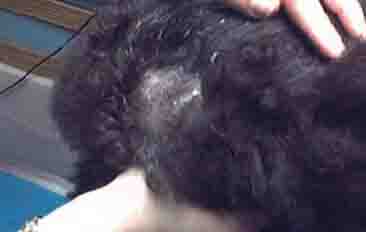 Dog Seborrhea - Example 1 Dog Seborrhea - Example 1