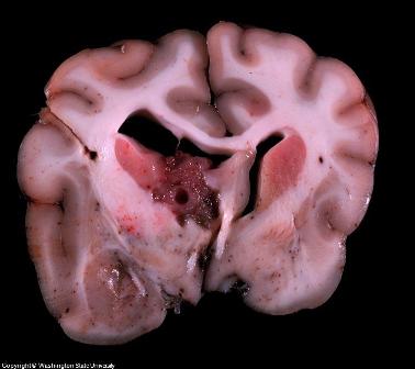 Dog Brain Tumor Symptoms Dog Brain Tumor Symptoms