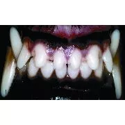 Long Muzzle Greyhound Anterior Canine Teeth Long Muzzle Greyhound Anterior canine teeth