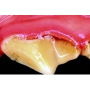 canine gingivitis picture Canine Gingivitis