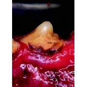 Canine Periodontal Disease, Infected and Inflamed Gums Canine Periodontal Disease, Infected and Inflamed Gums