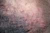 Dog Skin Pimple Dog Skin Pimple