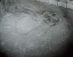 Pregnant Canine Bitch - X-ray Example Pregnant Canine Bitch - X-ray Example