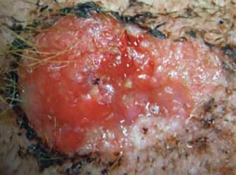Canine Squamous Cell Carcinoma