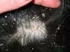 Dog Dry Flaking Skin and Hair Loss