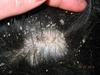 Dog Dry Flaking Skin and Hair Loss